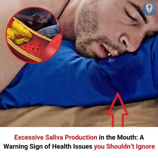 Excessive Saliva Production in the Mouth