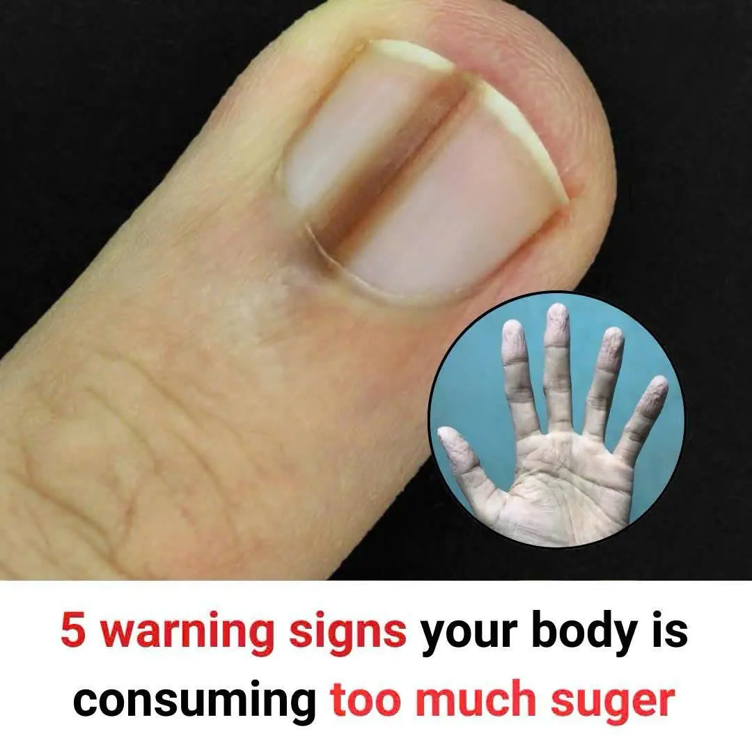 5 warning signs your body is consuming too much suger